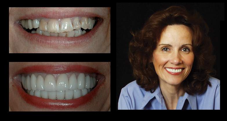 before & after photo gallery at IncredibleSmiles Dentistry Venita