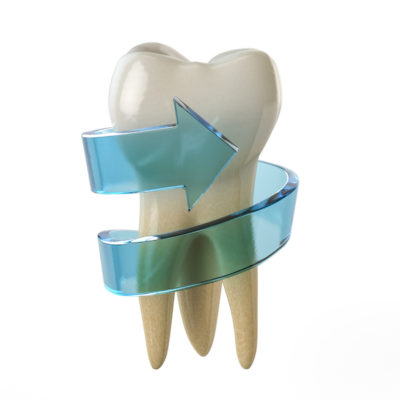 Learn more about root canal and root cause of illness at Incredible Smiles in Boulder, Colorado