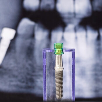 Treating dental implant failure