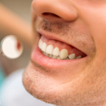 Dental restoration check up