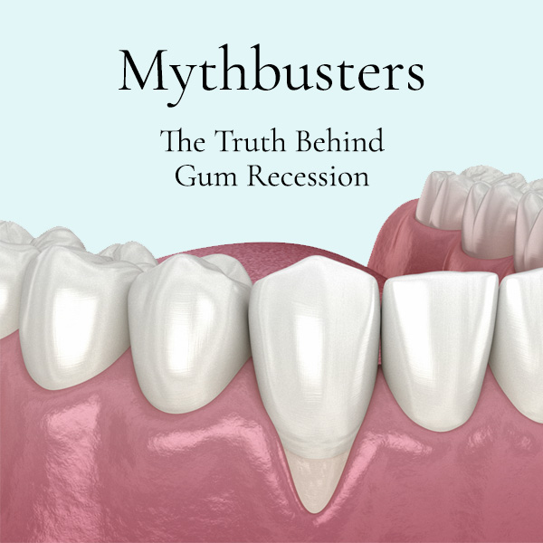 Gum recession mythbusters