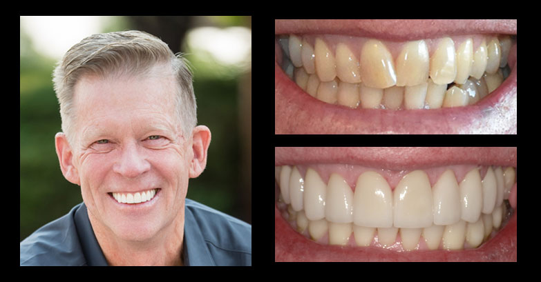 Before and After Gallery