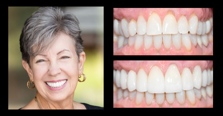 Before and After Gallery