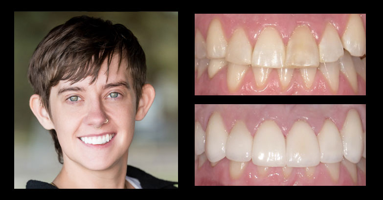 Before and After Gallery