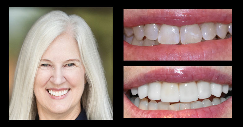 Before and After Gallery